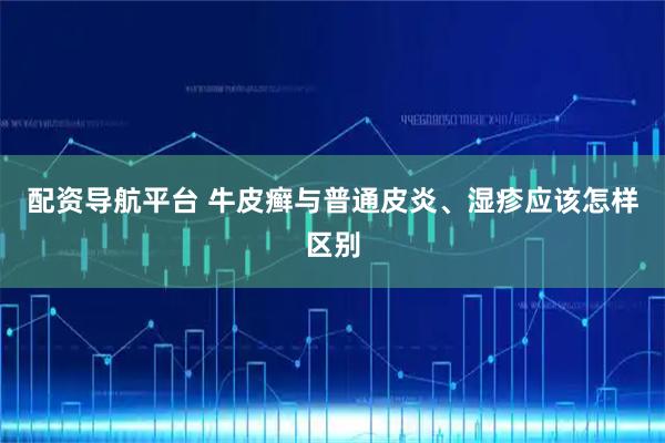 配资导航平台 牛皮癣与普通皮炎、湿疹应该怎样区别